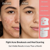 Silicone 4-in-1 Light Therapy Mask
