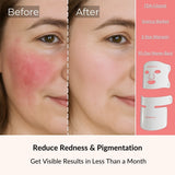 Silicone 4-in-1 Light Therapy Mask