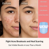 Therashield 3-in-1 Light Therapy Mask