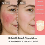 Therashield 3-in-1 Light Therapy Mask